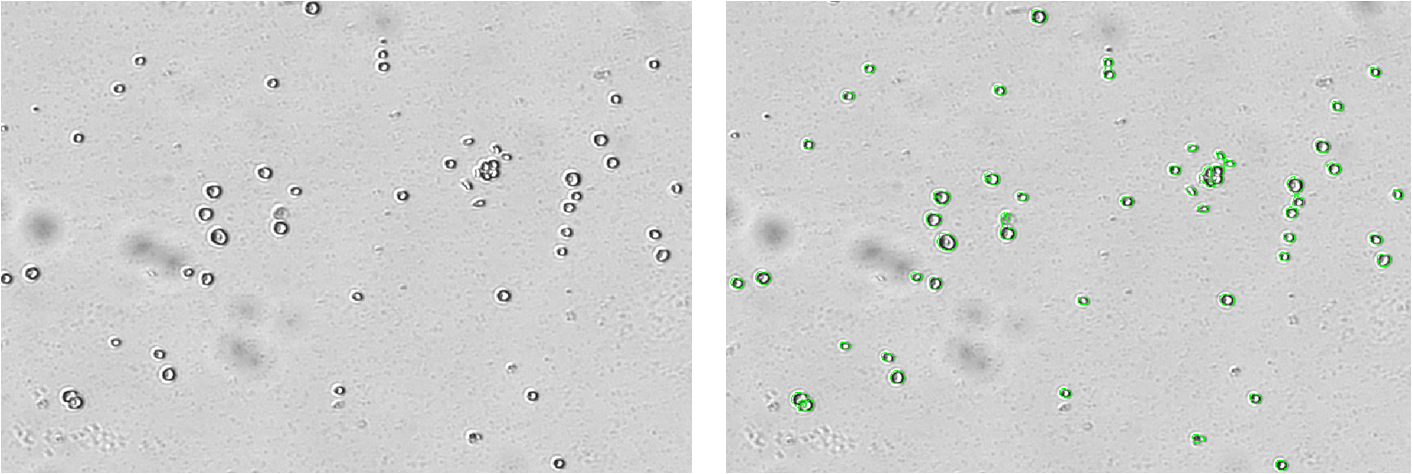 X2-algae BF.png X2-algae BF.png